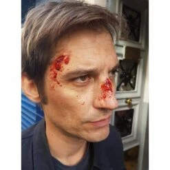 Prothèses Transfert - Coups Et Blessures